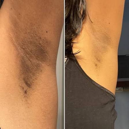Resultado Brightening Serum