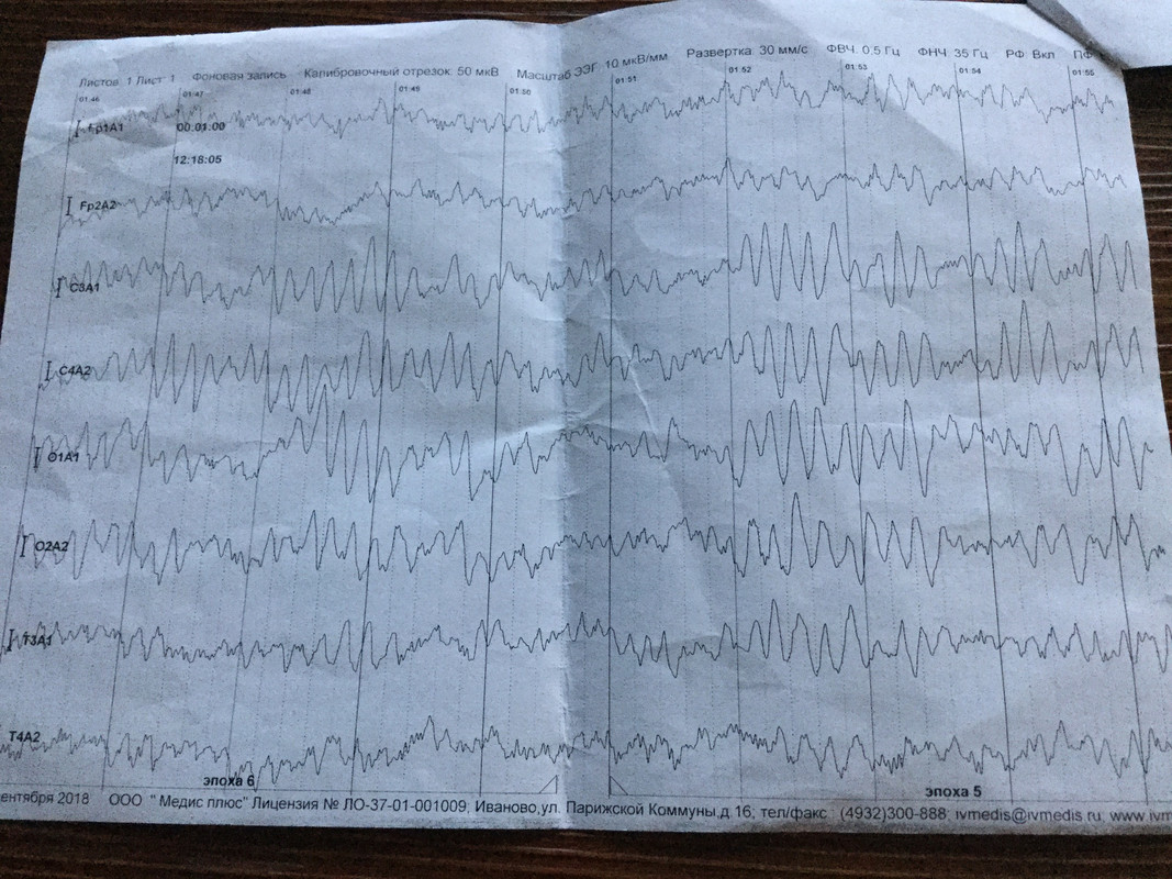 CF645AFF-7CF2-45B4-ADBC-ED8743881099