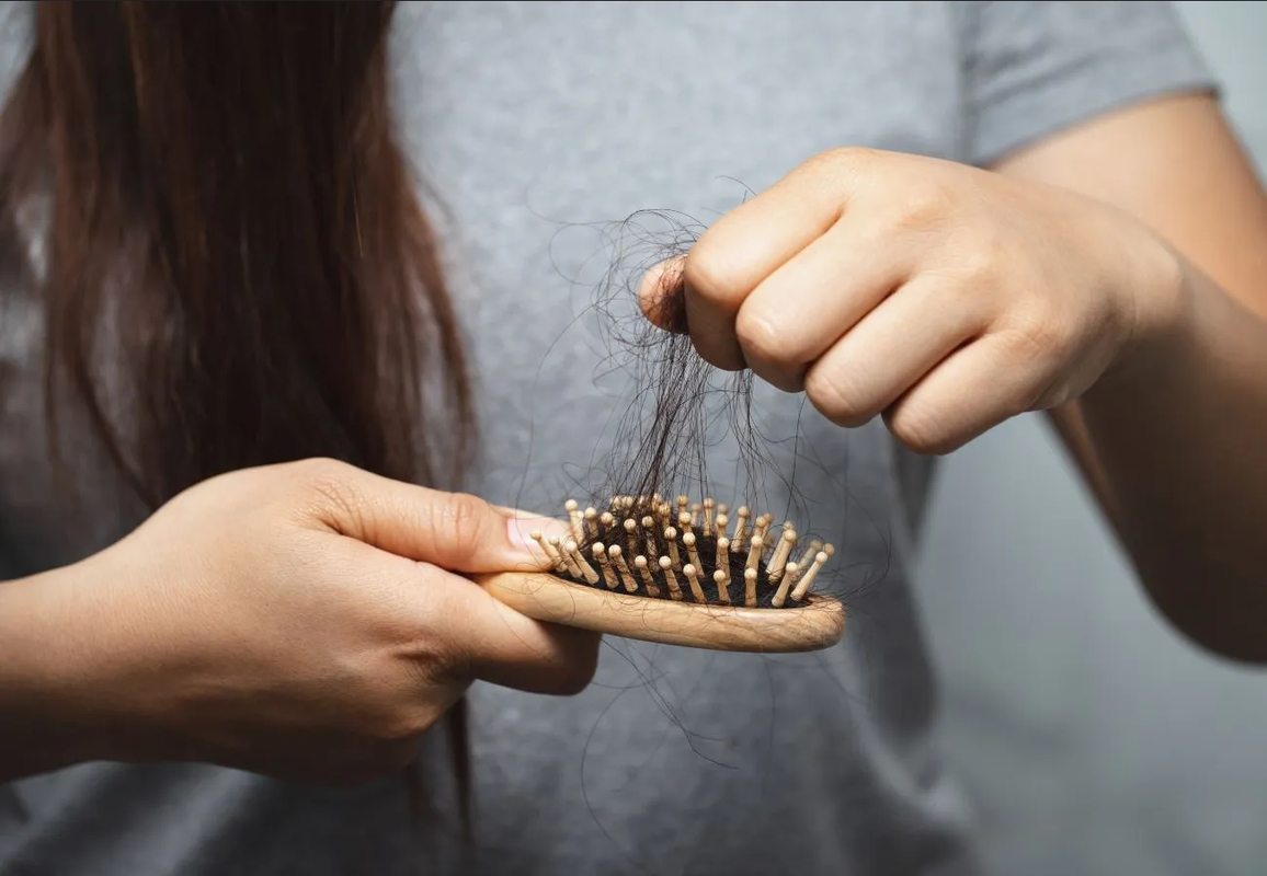 ¿Cómo detener la caída del cabello naturalmente?