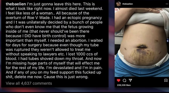 [PokeCommunity.com] Roe v Wade
