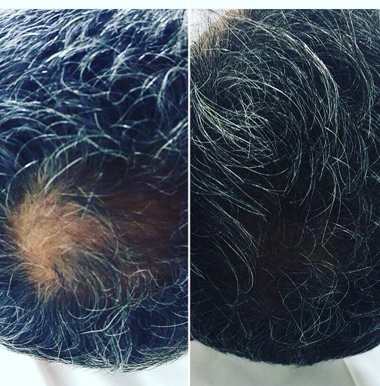 Resultado de Tratamento