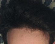 7. maggio 2020. Capello lungo, al buio. Potevo tenerlo sparato in aria che il cranio non si notava c