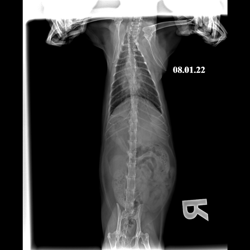 Грудная_клетка_ВД_08_01_22