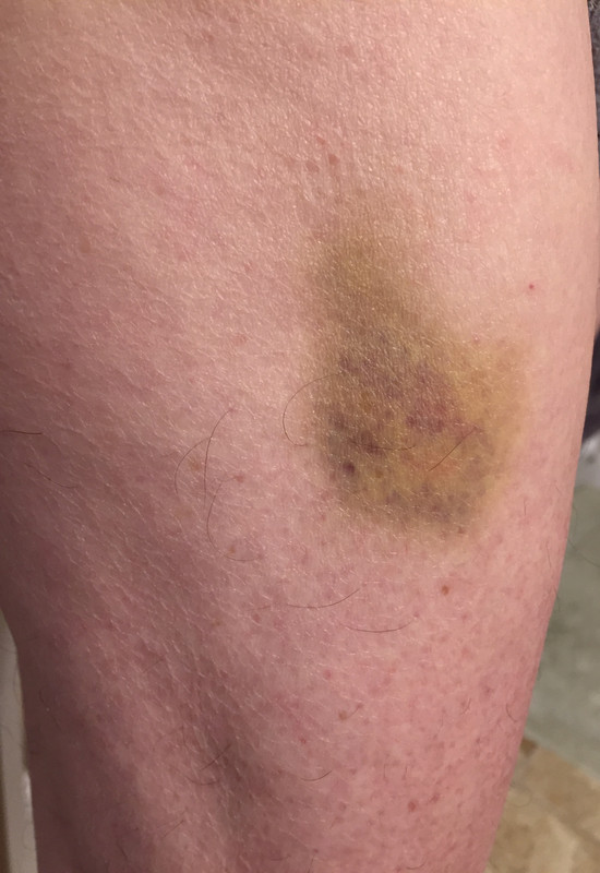 CB4DC438-BD27-4828-A694-237CC81CB6BE