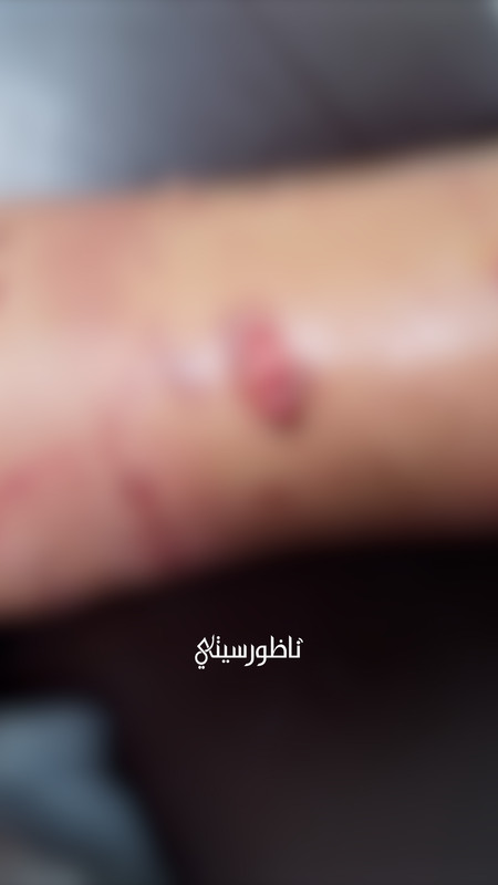 ALALI-L-00-17-07-12-Still012