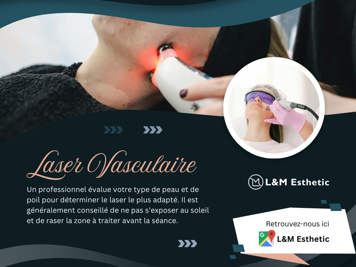 Laser Vasculaire