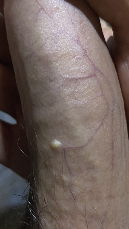 33A6E2CD-E790-4FEB-AF25-DAC49F721B50