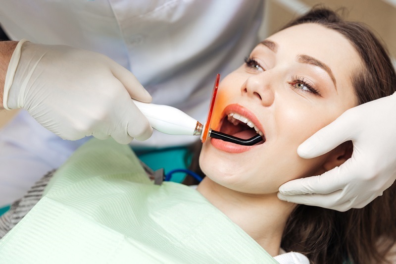 Teeth Bleaching 