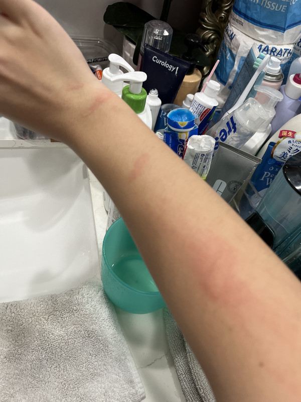 IMG 2942