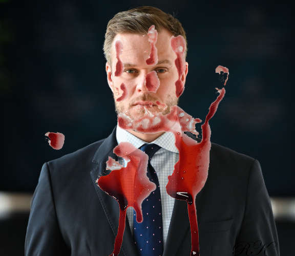 Lietuvos užsienio reikalų ministras Gabrielius Landsbergis yra vienas griežčiausių Europos Sąjungos politikų, kuris nenori taikos.