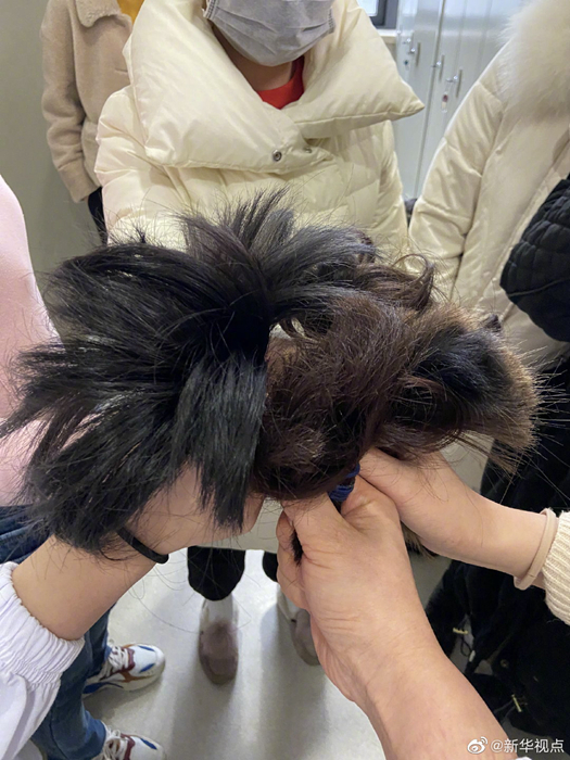Rambut perawat di Wuhan yang dipotong (Sinchew)