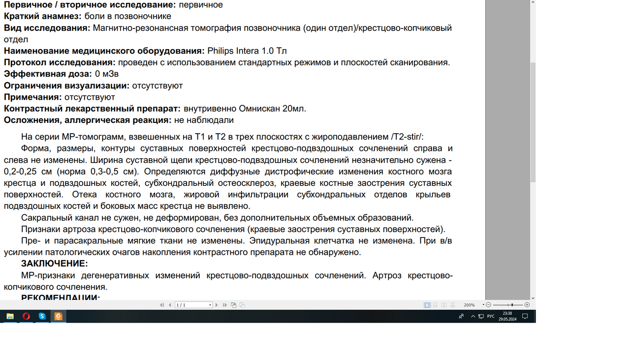 крестцово копчиковый