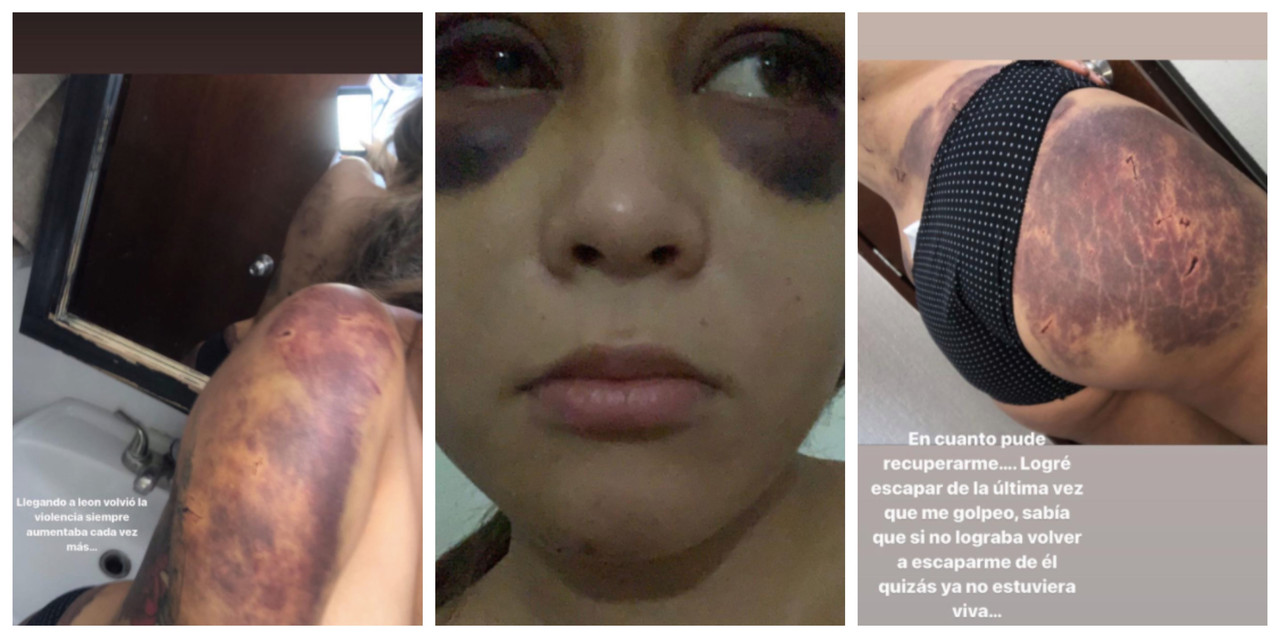 Influencer de Guanajuato denuncia en redes a su ex pareja por violencia física