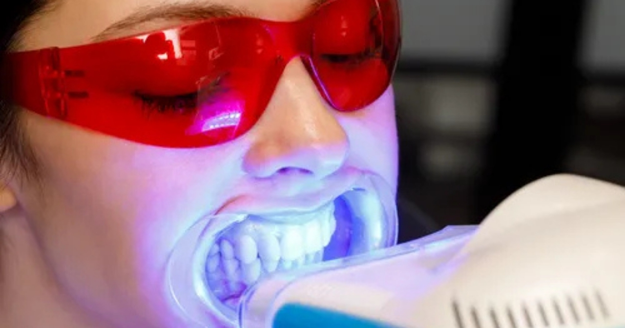  From Bollywood Smiles to Reality: Cosmetic Dentistry Trends in Mumbai