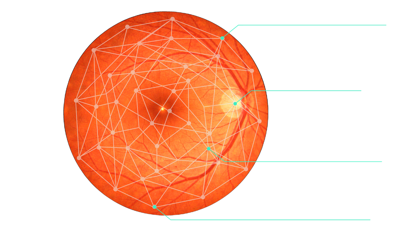 DOCTOR EYE Retina Scan
