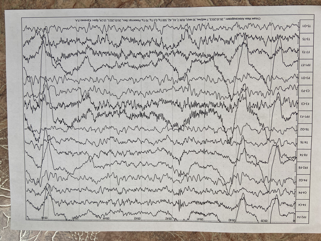 6FDCDE5A-B59A-4299-A9DB-370554B60818