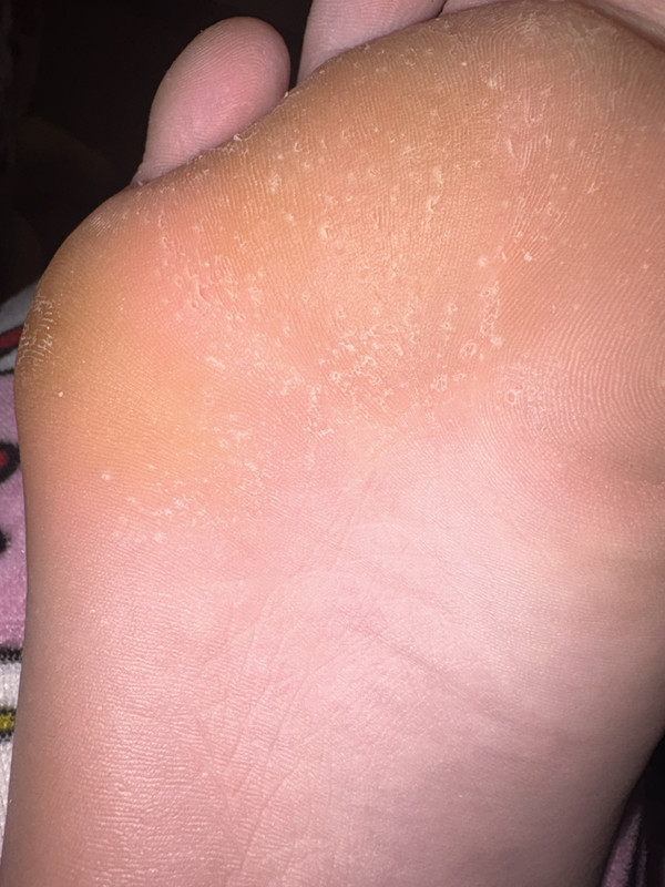 IMG 1193