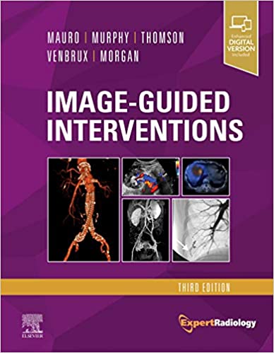 Image-Guided Interventions  Expert Radiology Series, 3rd Edition