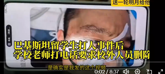 https://i.postimg.cc/T3BFFn3Y/imige-15.png