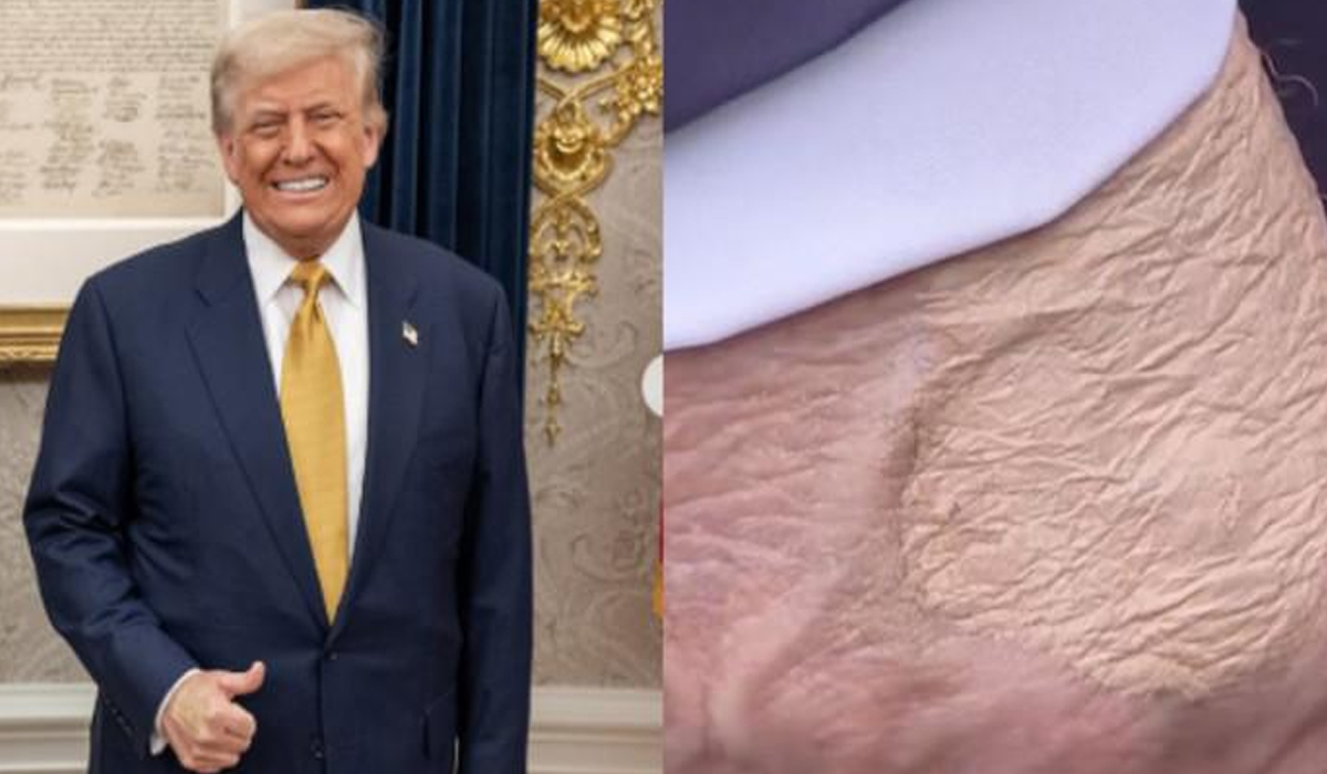 Detail Kondisi Kesehatan Trump Menurut Dokter Gedung Putih