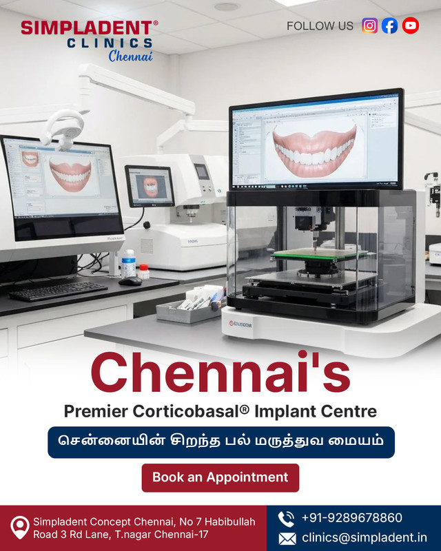 Best Dental Implant Clinic in Chennai
