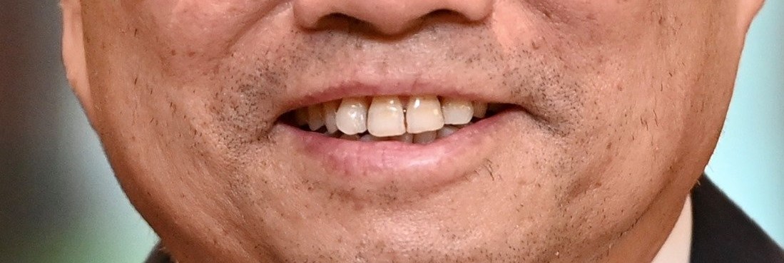 ddfcbca199876bd93296 GFYU