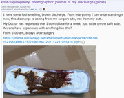 neo vaginal discharge