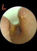 Left-inner