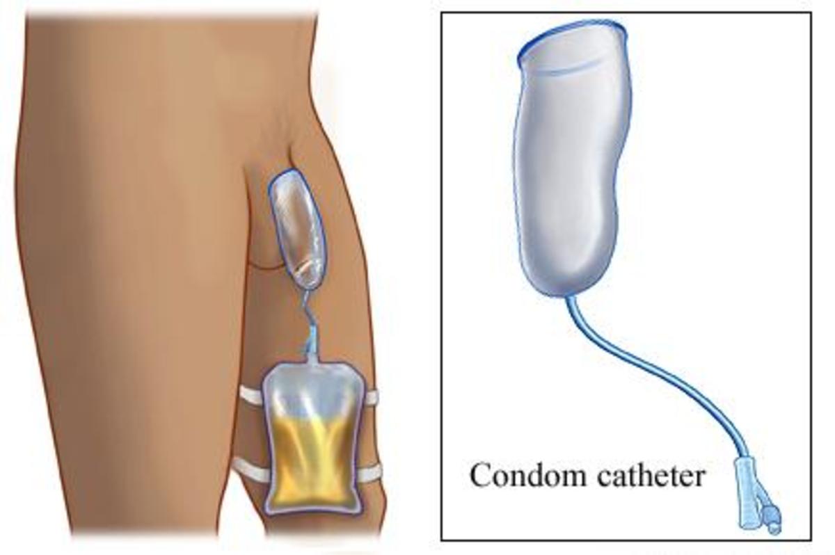 male-external-catheters