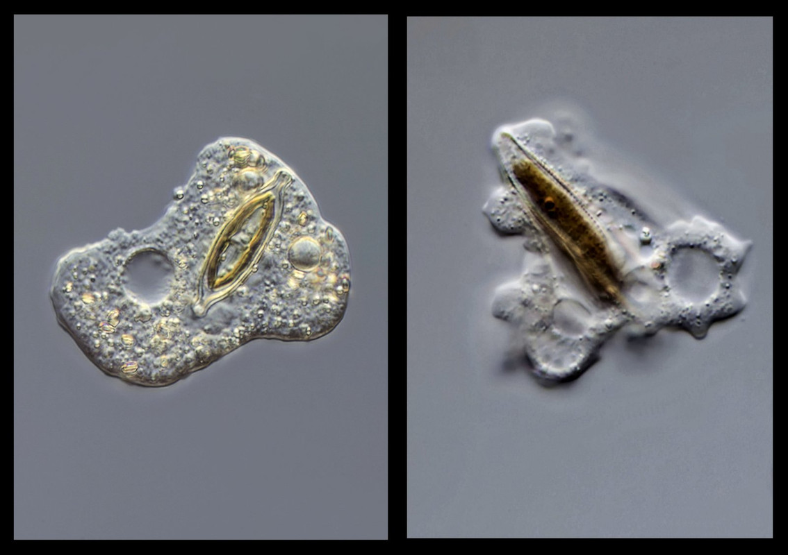 Fließamöben Deuteramoeba und Pelomyxa mit DiatomeenDIK 100 Komp
