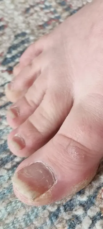 6-years-searching-for-diagnosis-just-found-multiple-v0-kwnego9yxyod1