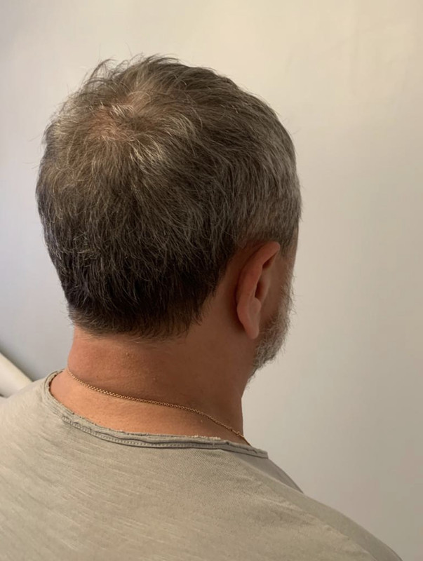 2452D1A7-2836-4A9C-9E3A-B538FE6680D6