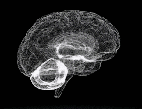 cerebrogifcorte