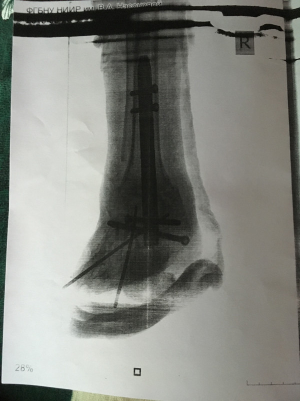 3919BAFE-2CDF-4EEA-84D4-66A5428D8EE8