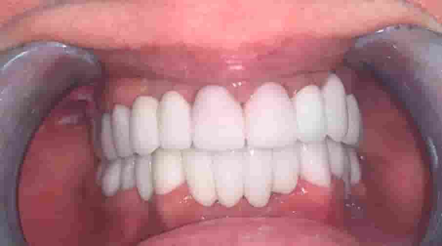 Before