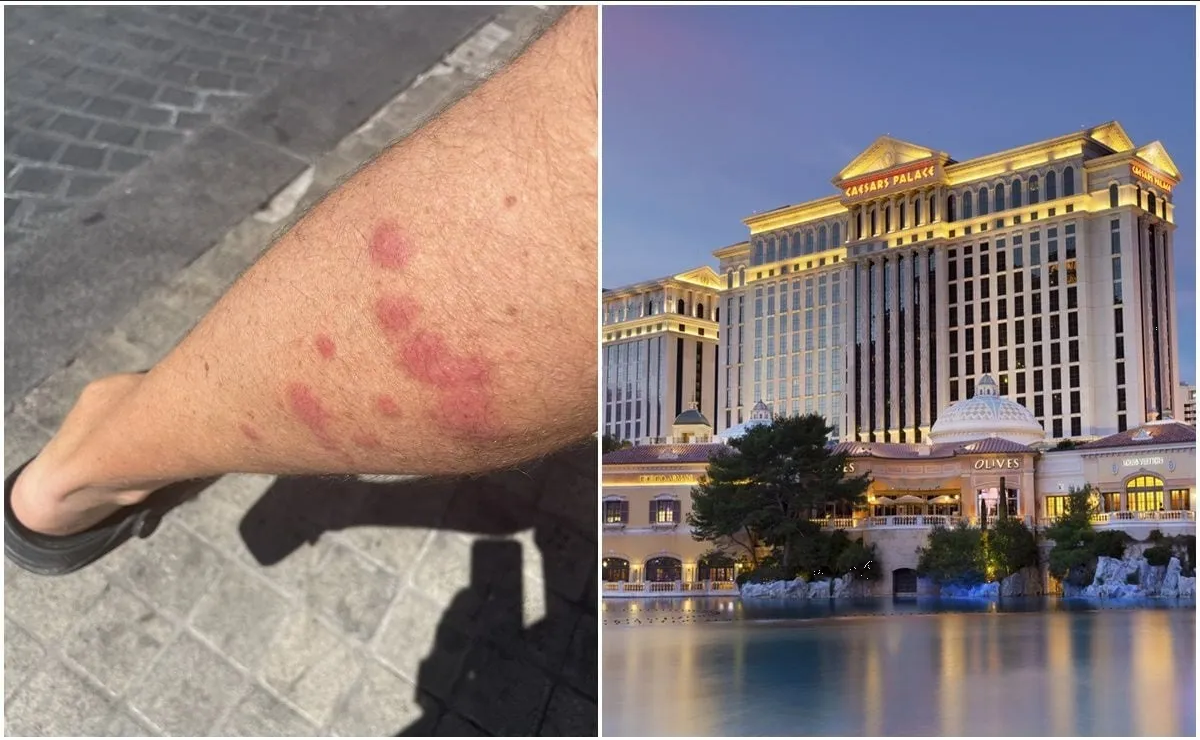 Brote de chinches en Las Vegas: hoteles de lujo afectados