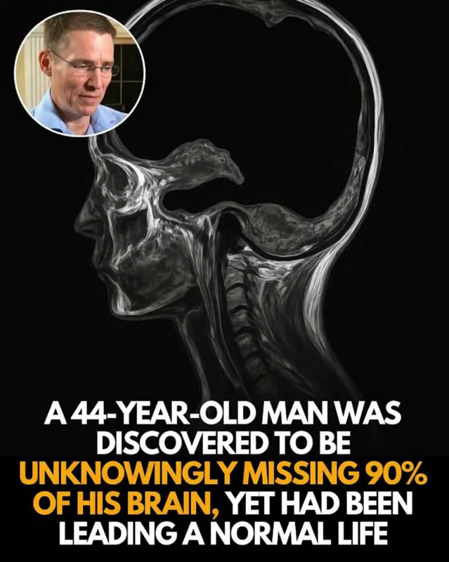 he-only-found-out-when-he-went-to-see-a-