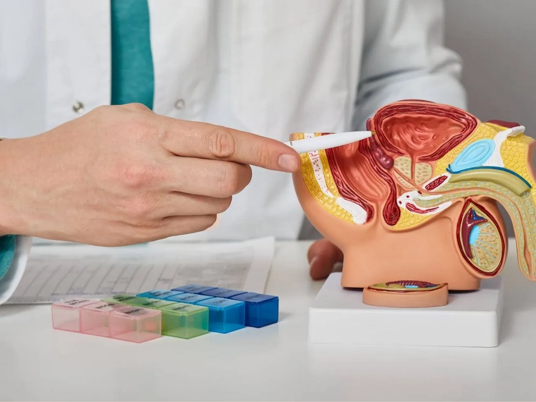 Hombres con estos síntomas tienen hasta 27% más riesgo de cáncer de próstata