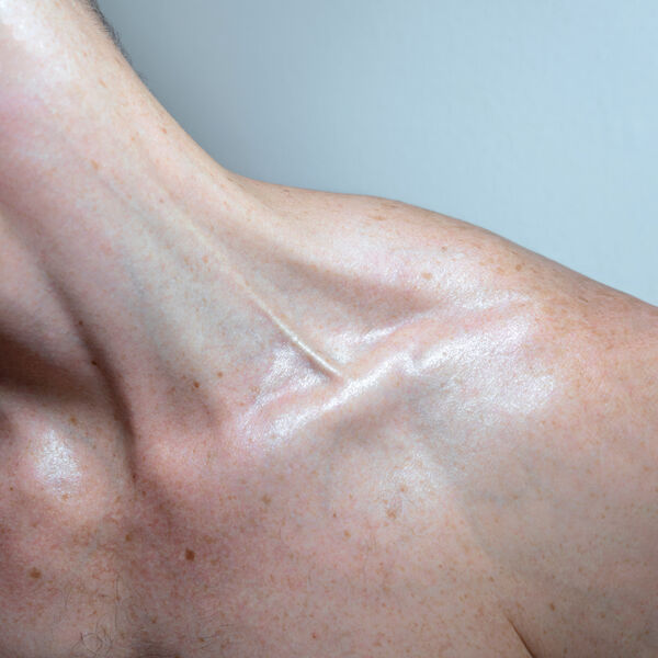 [Image: 2qvuir1kqe21.jpg]