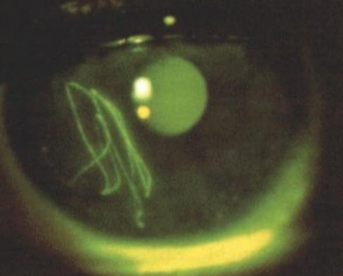 Ophthalmology question 5 image