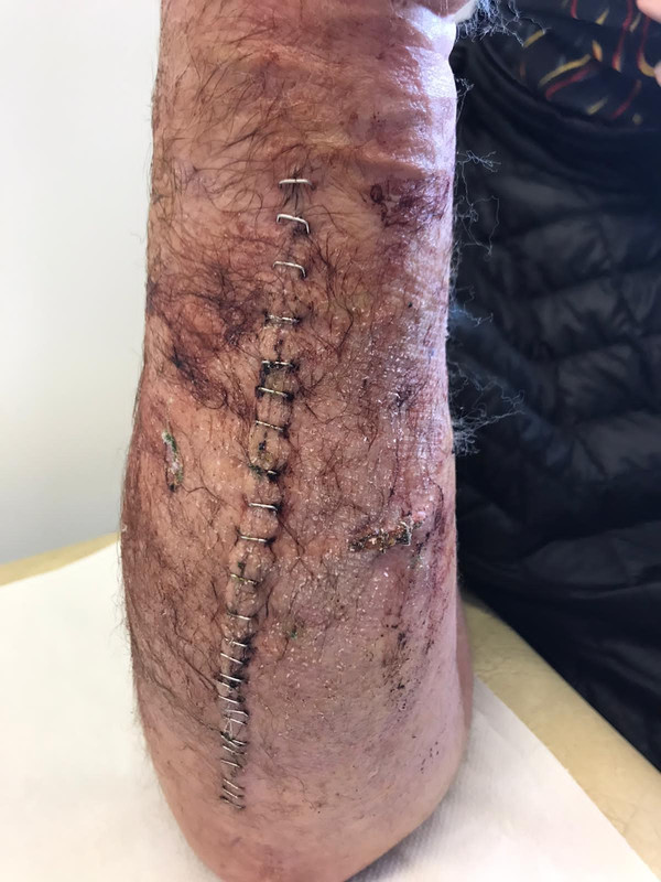 06381CD3-B997-4726-A350-4A683F8A2253