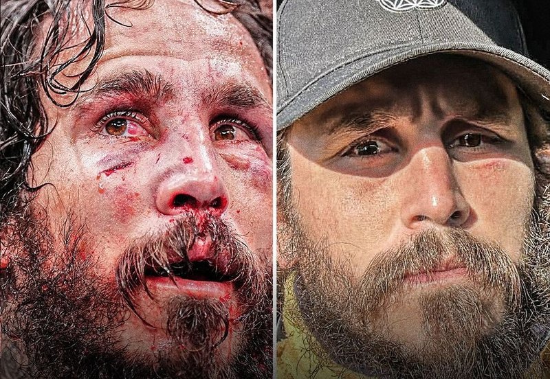 Вижте как изглежда Марлон Вера 9 дни след UFC 299