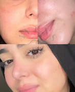 Skin Revive Result 2
