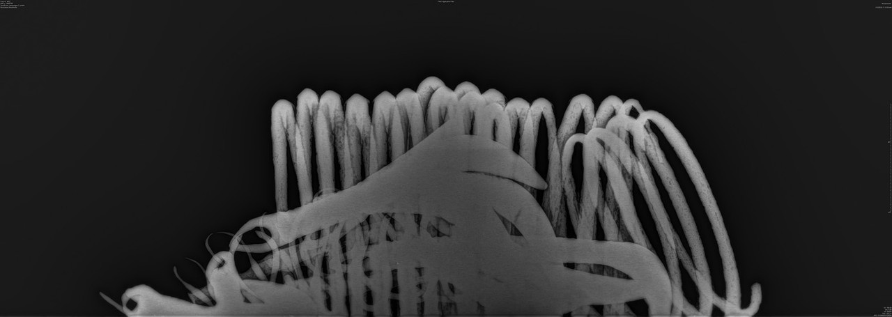 Röntgen KM42755 (RR2)