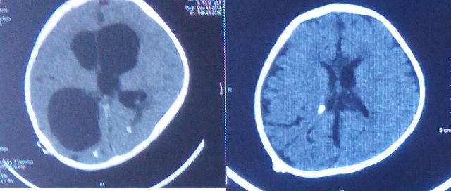 дисфункция март этого года