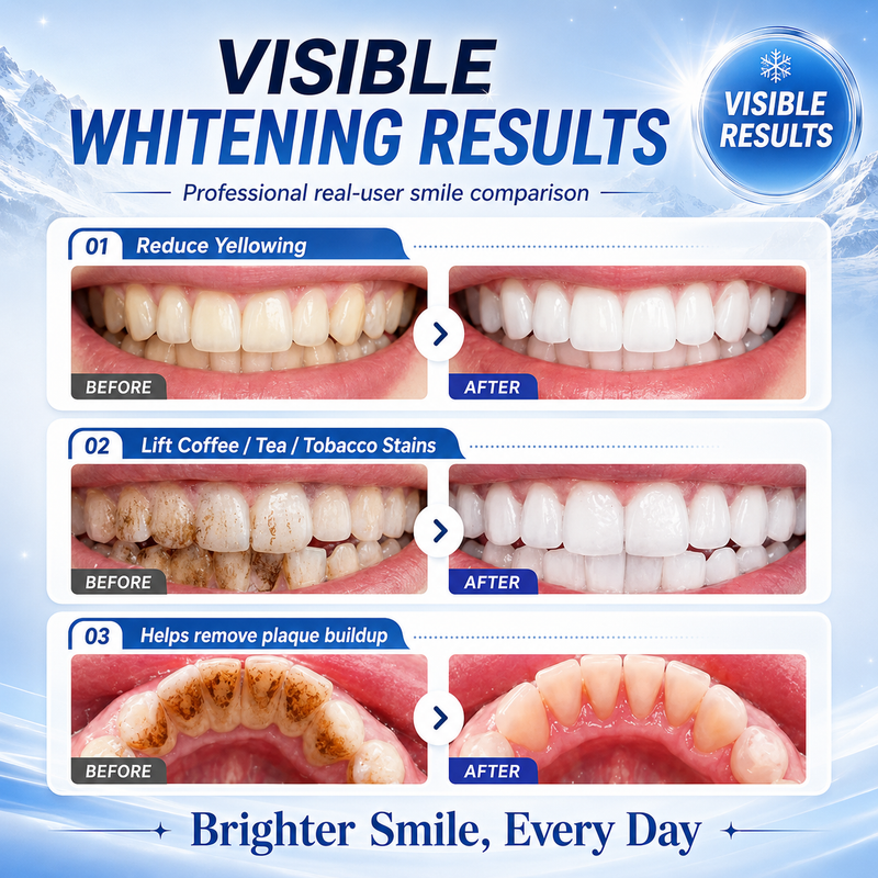 Visible Whitening Results