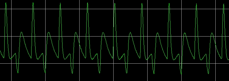 5227_vystup_-_volume_10_-_gain_10_-_treble_7_zk