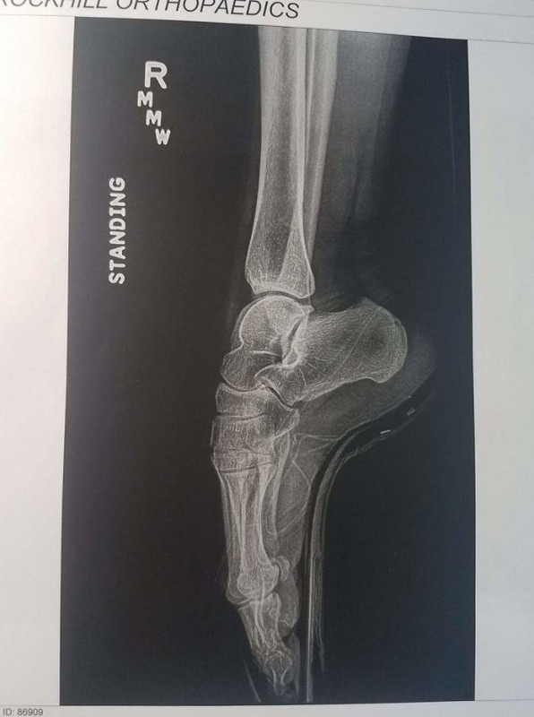 Rayos-X-2