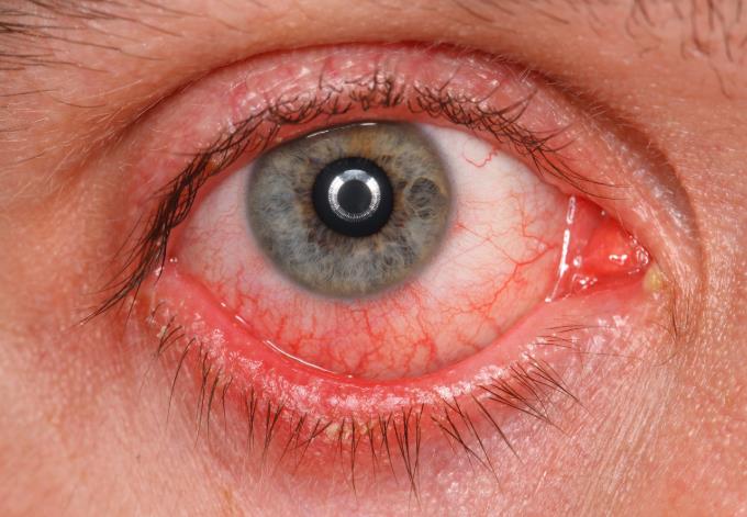 Rheumatology question 6 image