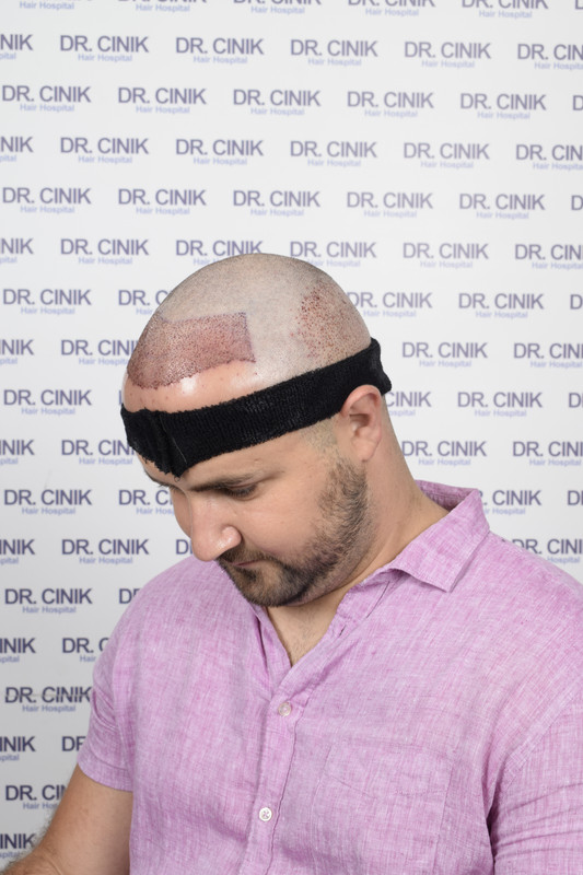 photos postopératoires (8)